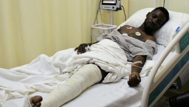Ugandan Opposition Leader Bobi Wine Shot In Leg In Clash With Police
