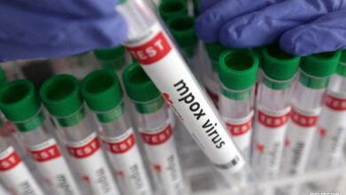 Mpox Patient At Delhi Hospital Stable, No Need To Panic: Aap Minister