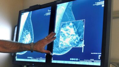 Breast Cancer Is Rising Among U.s. Young Women Even As Deaths Drop: Study
