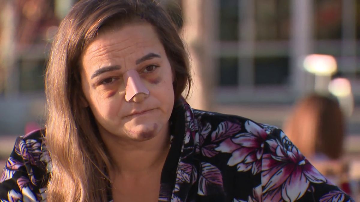 ‘how Am I Still Here?’: Woman Who Survived Horrific North Edmonton Crash Speaks About Her Recovery