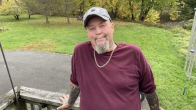 A N.b. Man Was Disfigured In A Car Crash. A Prosthetic From A Former Spy Changed His Life