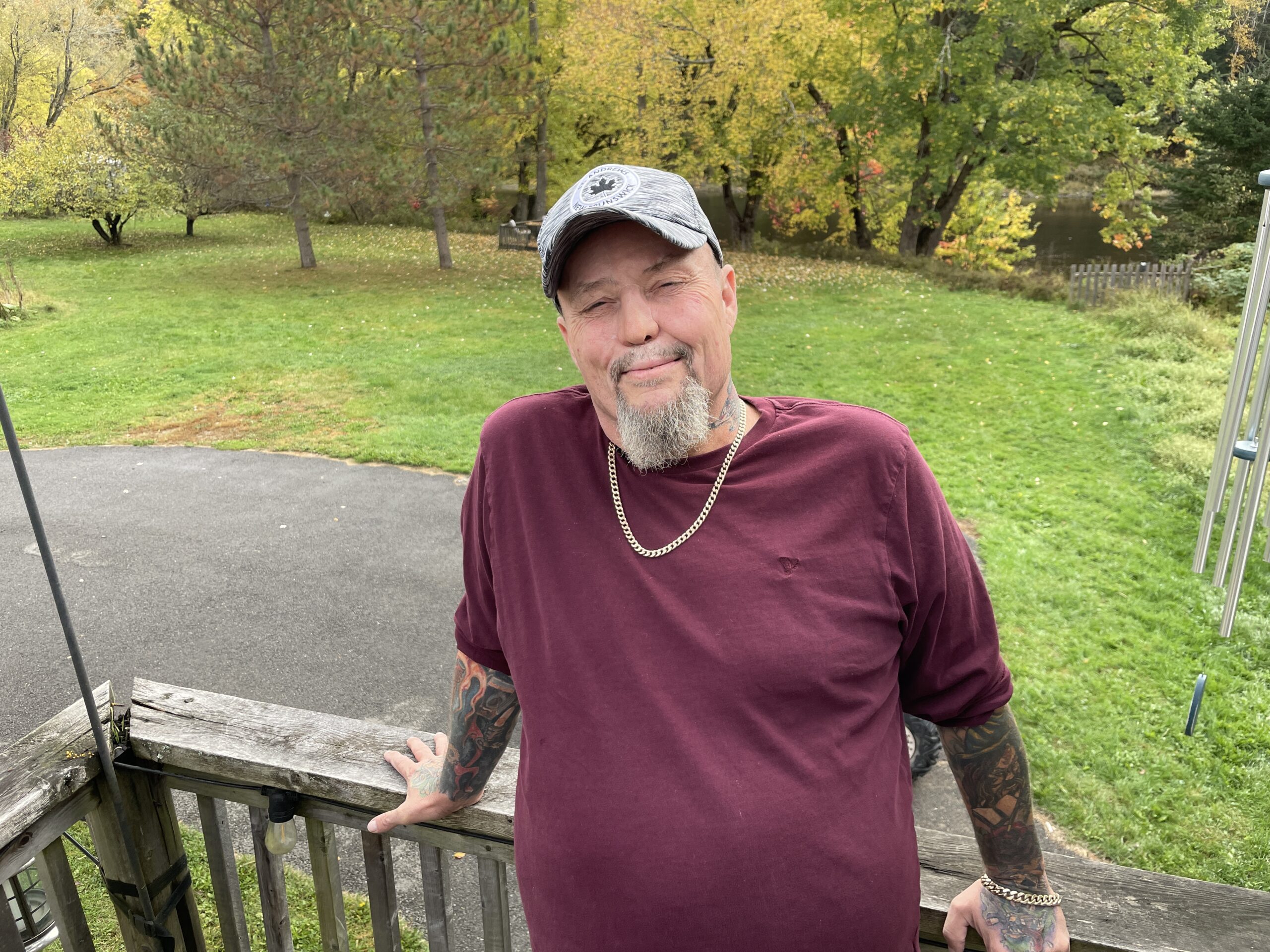 A N.b. Man Was Disfigured In A Car Crash. A Prosthetic From A Former Spy Changed His Life