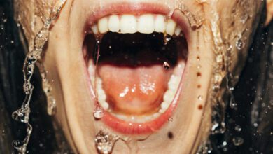 Rfk Jr. And Trump Want Fluoride Out Of Water. What Does The Mineral Do?