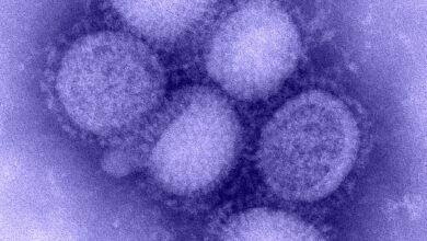 Electron microscope image of Influenza A H1N1 virus particles