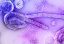 Electron micrograph showing Ebola virus particles
