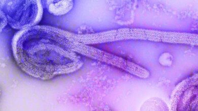 Electron micrograph showing Ebola virus particles