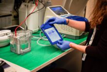 A researcher checks western blots in a laboratory.