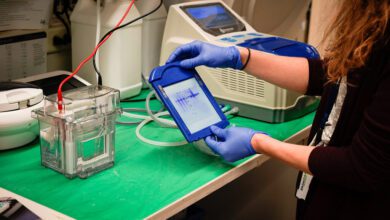 A researcher checks western blots in a laboratory.